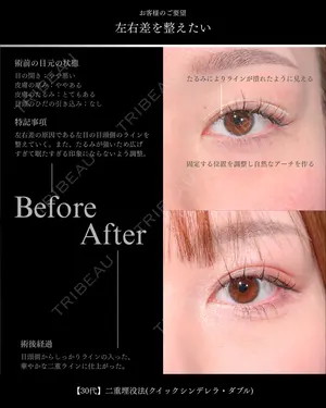 before image