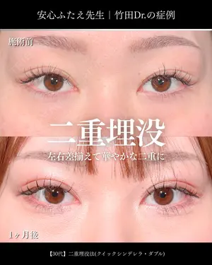 30 days after image