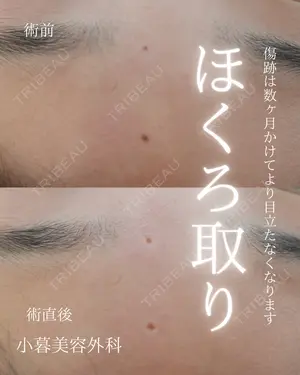 before image
