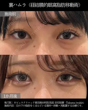 before image