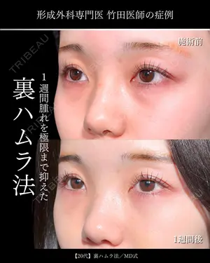 6 days after image