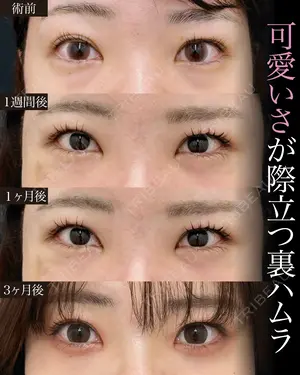 null days after image