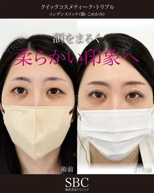 before image