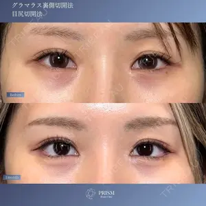 30 days after image