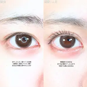 before image