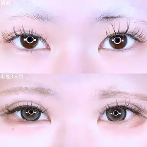 90 days after image