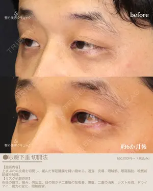before image