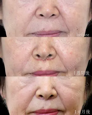 30 days after image