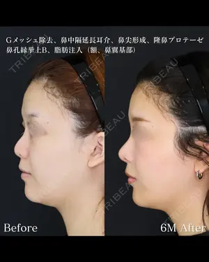 null days after image