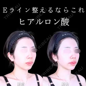 0 days after image