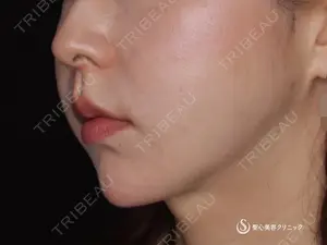 90 days after image