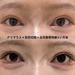 null days after image