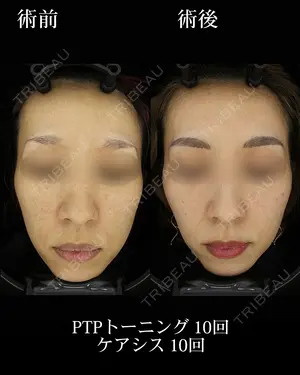 1100 days after image