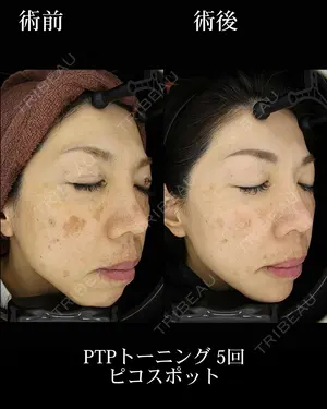 550 days after image