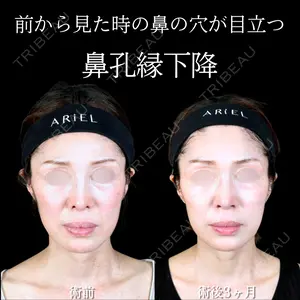 90 days after image
