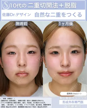 30 days after image