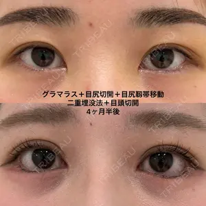 before image