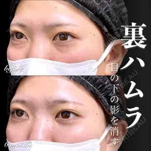 before image