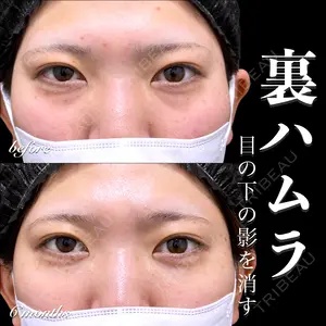180 days after image