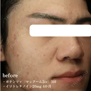 before image
