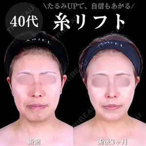 90 days after image