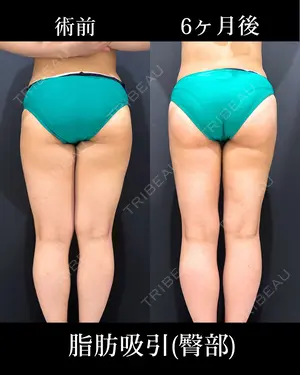 180 days after image