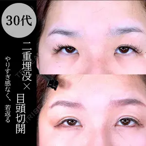 90 days after image