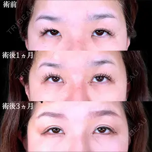 before image