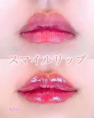 0 days after image