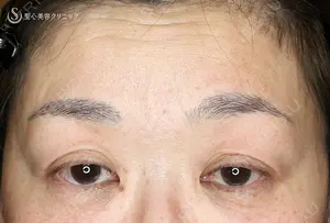 before image
