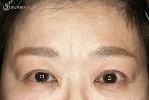 30 days after image