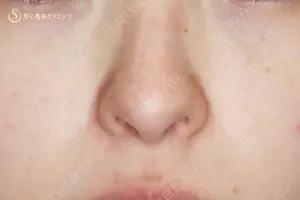 850 days after image
