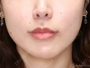 30 days after image