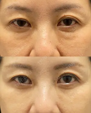 90 days after image