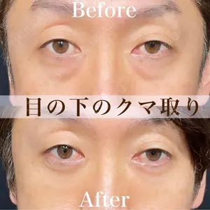 90 days after image