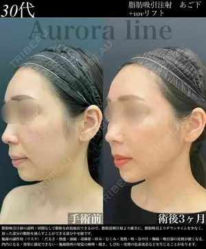 90 days after image