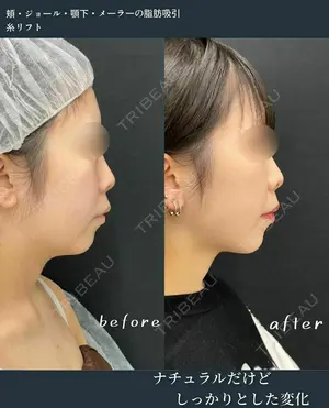 60 days after image
