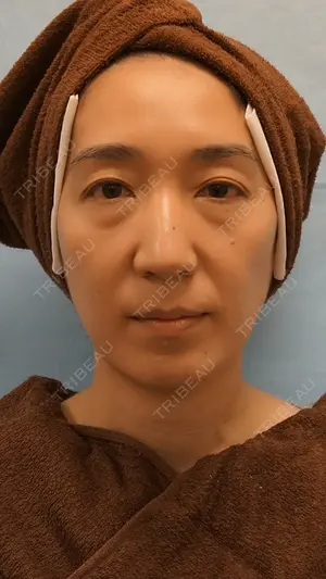 before image