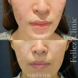 90 days after image