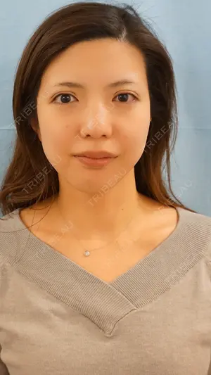 7 days after image