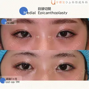 30 days after image
