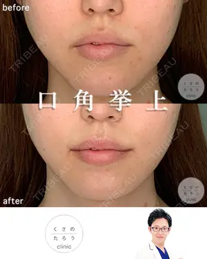 null days after image