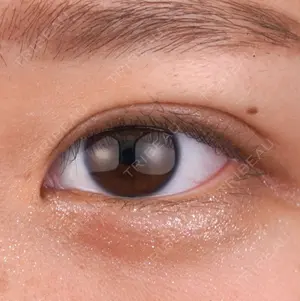 7 days after image