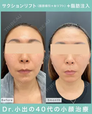 90 days after image