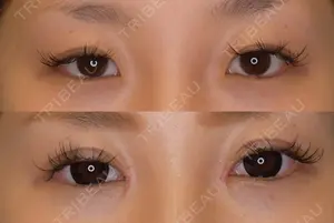90 days after image