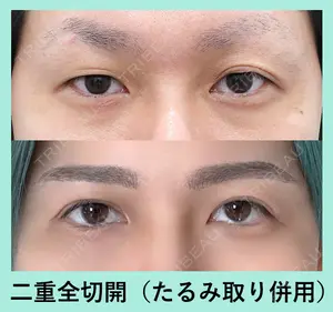 60 days after image