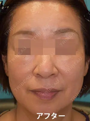 60 days after image