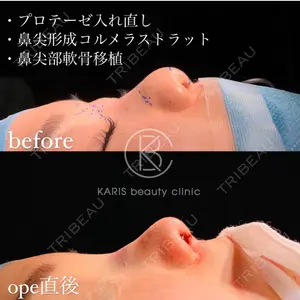 before image