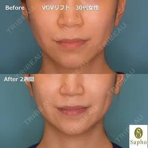 30 days after image