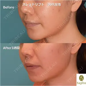 21 days after image